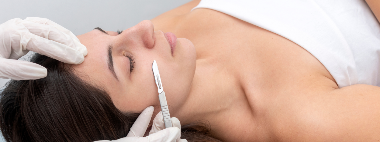Dermaplaning treatment image