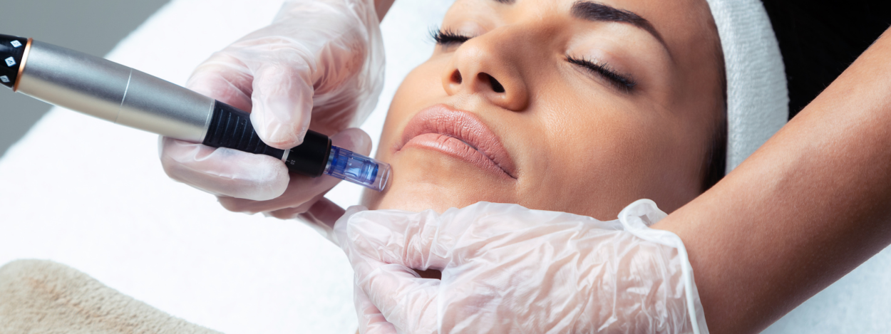 Microneedling service image