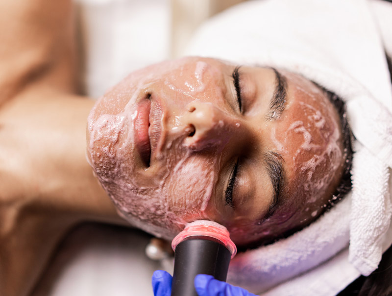 OxyGeneo facial treatment image