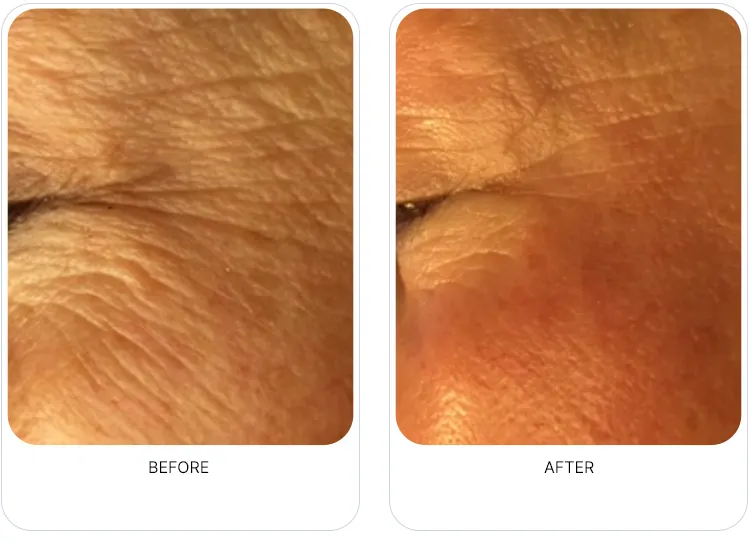 Close-up OxyGeneo result image from the partner page
